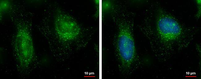 FAM21C Antibody - BSA Free