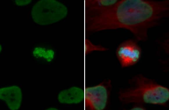 HIST1H3A [ac Lys18] Antibody