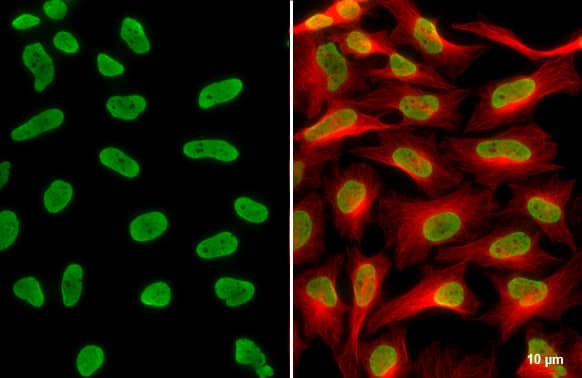 HIST1H3A [ac Lys18] Antibody