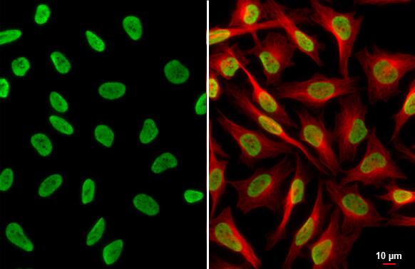 HIST1H3A [ac Lys18] Antibody
