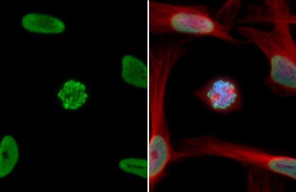 HIST1H3A [ac Lys18] Antibody