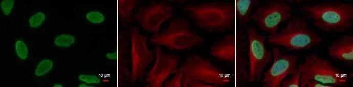 HIST1H3A [ac Lys18] Antibody