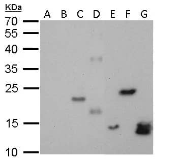 His Tag Antibody (359)