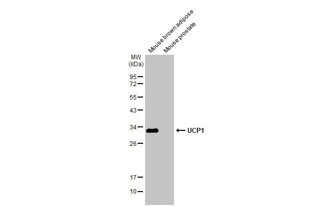 UCP1 Antibody (1345)