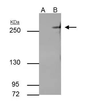 TET2 Antibody (649)