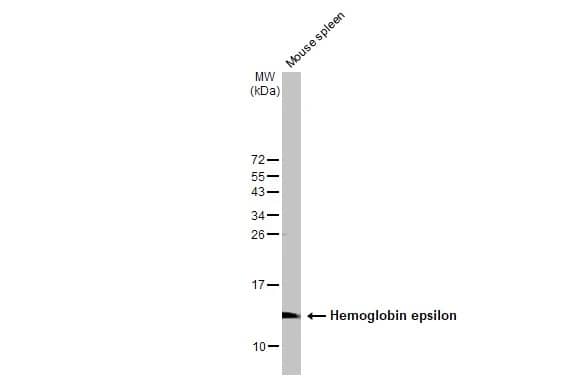 Hemoglobin epsilon Antibody