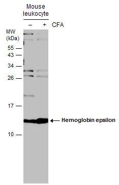 Hemoglobin epsilon Antibody - BSA Free