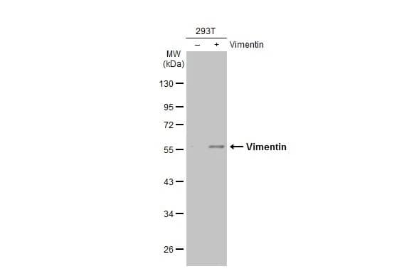 Vimentin Antibody (812)