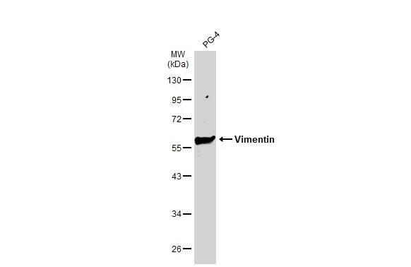Vimentin Antibody (812)