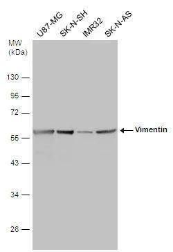 Vimentin Antibody (812) - Azide and BSA Free