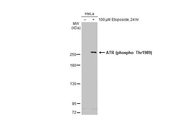 ATR [p Thr1989] Antibody (222)