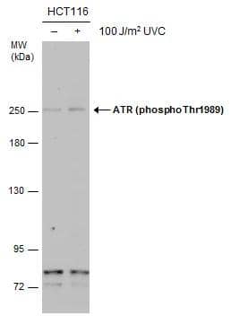 ATR [p Thr1989] Antibody (222) - Azide and BSA Free