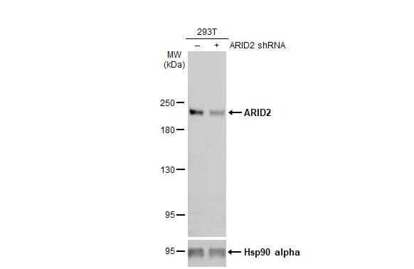 ARID2 Antibody (7311)