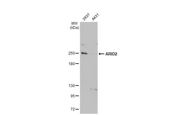 ARID2 Antibody (7311)