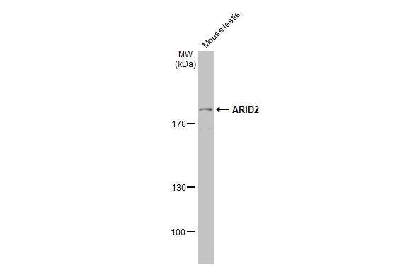 ARID2 Antibody (7311) - Azide and BSA Free