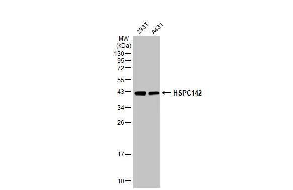 MERIT40/HSPC142 Antibody (1251)