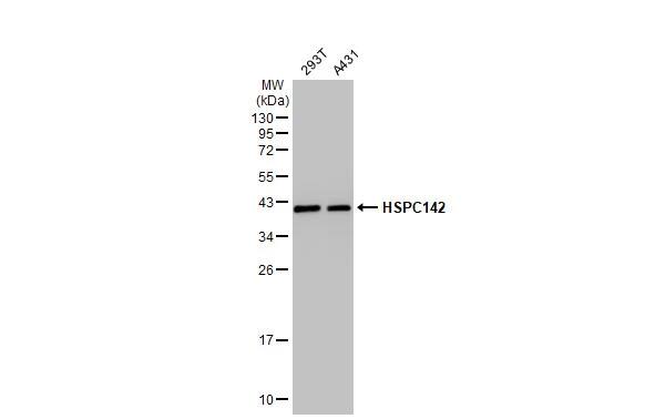 MERIT40/HSPC142 Antibody (2810)
