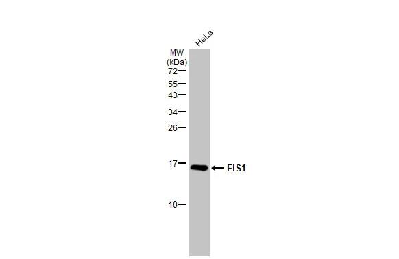 TTC11 Antibody (9810)