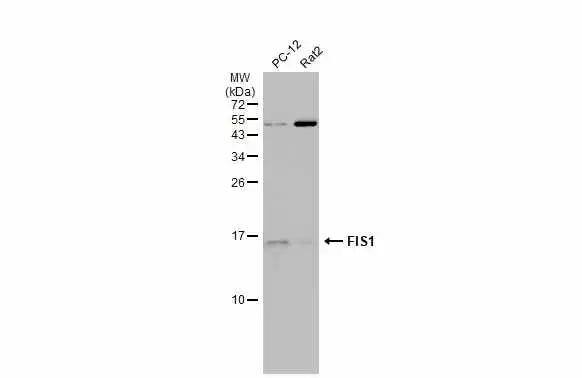TTC11 Antibody (9810) - Azide and BSA Free