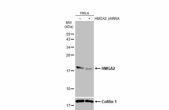 HMGA2 Antibody (763)