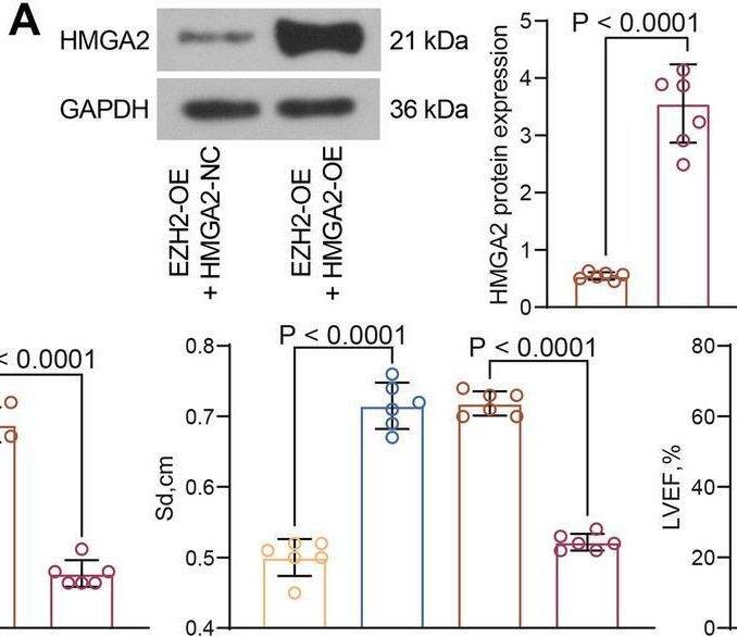 HMGA2 Antibody (763) - Azide and BSA Free