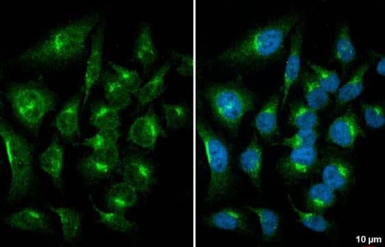 TOR/mTOR Antibody (6611) TOR/mTOR Antibody (6611)