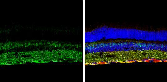 p62/SQSTM1 Antibody (1478) - Azide and BSA Free