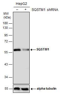 p62/SQSTM1 Antibody (1478) - Azide and BSA Free