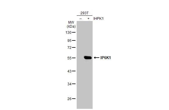 IP6K1 Antibody (10611)