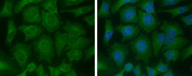 ME1 Antibody (979) - Azide and BSA Free