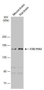 Collagen XI alpha 2 Antibody (473) - Azide and BSA Free