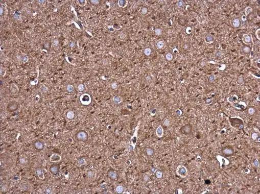 Filamin B Antibody (1372) - Azide and BSA Free