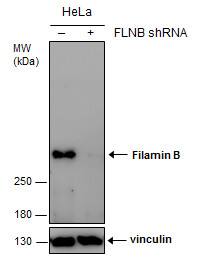 Filamin B Antibody (387) - Azide and BSA Free