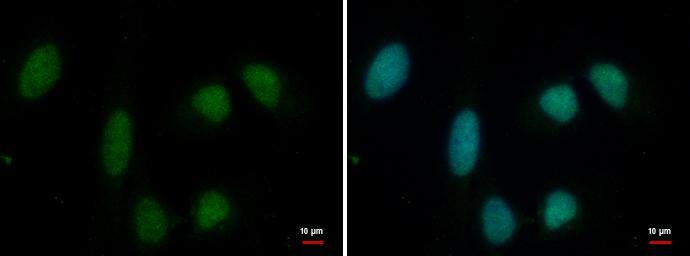 PRMT1 Antibody (779) - Azide and BSA Free