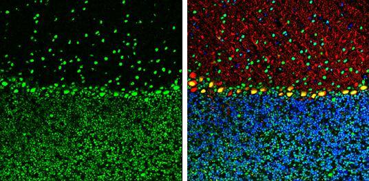 ARID5A Antibody (18112) - Azide and BSA Free