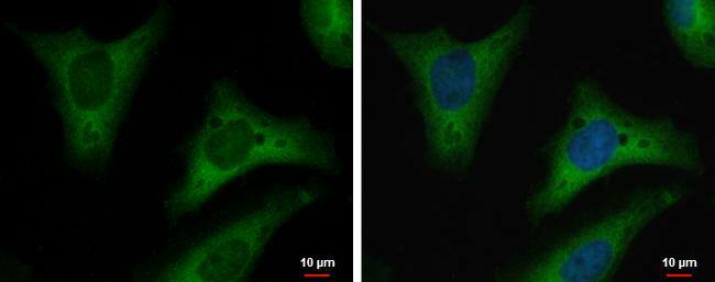 Triosephosphate isomerase Antibody (181) - Azide and BSA Free