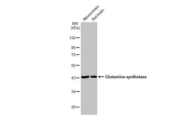 Glutamine Synthetase Antibody (7711)
