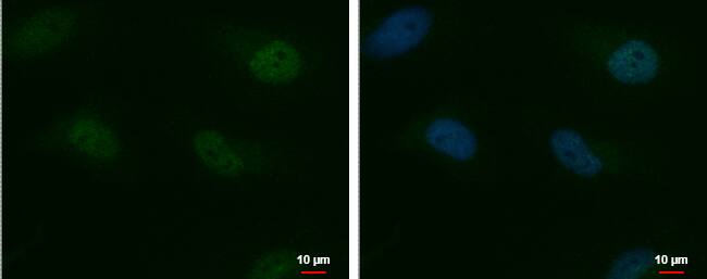 MTF2 Antibody