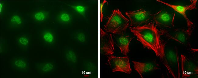 MTF2 Antibody