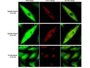 Muscle Phosphofructokinase/PFKM/PFK-1 Antibody
