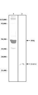 Muscle Phosphofructokinase/PFKM/PFK-1 Antibody
