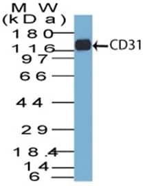 CD31/PECAM-1 Antibody (C31.7) - IHC-Prediluted Western Blot: CD31/PECAM-1 Antibody (C31.7) - IHC-Prediluted [NBP2-44333] -
