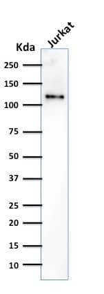 CD31/PECAM-1 Antibody (SPM532) - IHC-Prediluted Western Blot: CD31/PECAM-1 Antibody (SPM532) - IHC-Prediluted [NBP2-44335] -