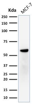 ER beta/NR3A2 Antibody (ERb455) - IHC-Prediluted Western Blot: ER beta/NR3A2 Antibody (ERb455) - IHC-Prediluted [NBP2-44365] -