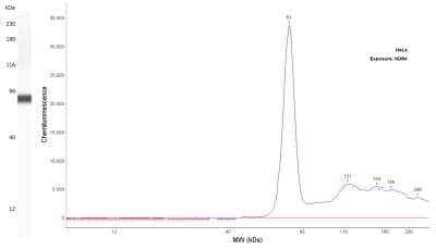 Fascin Antibody (FSCN1/417)