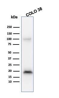 Melan-A/MART-1 Antibody (M2-9E3) - IHC-Prediluted Western Blot: Melan-A/MART-1 Antibody (M2-9E3) - IHC-Prediluted [NBP2-44388] -