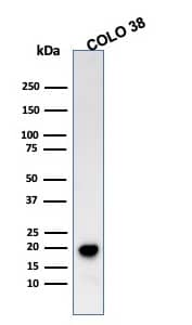 Melan-A/MART-1 Antibody (SPM555) - IHC-Prediluted Western Blot: Melan-A/MART-1 Antibody (SPM555) - IHC-Prediluted [NBP2-44391] -
