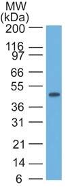 Cytokeratin 17 Antibody (E3 (same as Ks17.E3)) - IHC-Prediluted Western Blot: Cytokeratin 17 Antibody (E3 (same as Ks17.E3)) - IHC-Prediluted [NBP2-44425] -