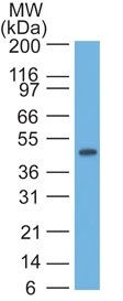 Cytokeratin 17 Antibody (SPM560) - IHC-Prediluted Western Blot: Cytokeratin 17 Antibody (SPM560) - IHC-Prediluted [NBP2-44426] -