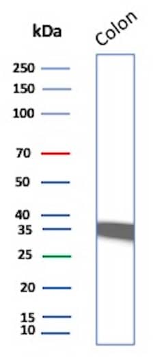 Calponin 1 Antibody (CNN1/832) Western Blot: Calponin 1 Antibody (CNN1/832) [NBP2-44481] -